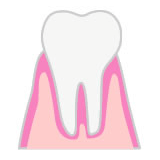 健康な状態の歯と歯ぐき